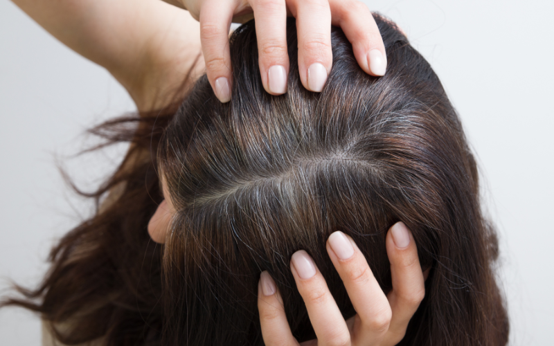 girl showing her hair roots