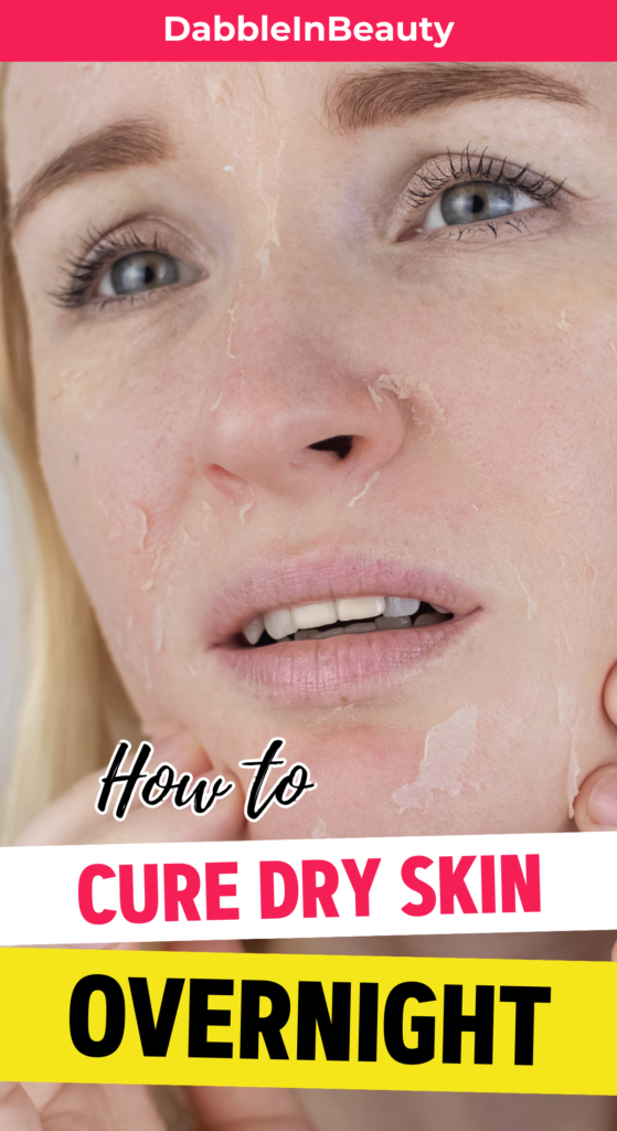 Causes of Dry Skin